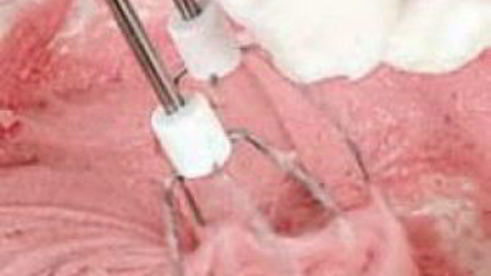 мусс клюквенный из манной крупы