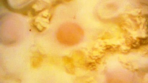 глазунья с творогом